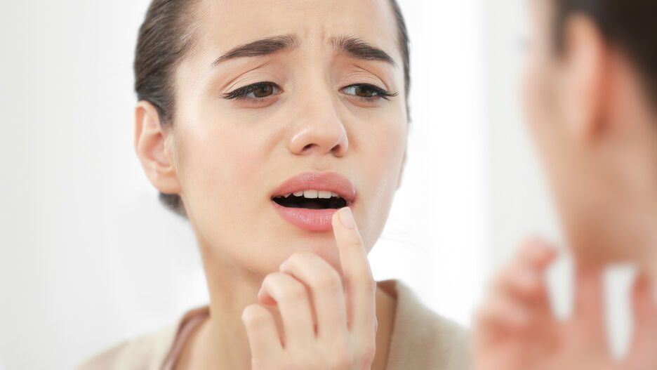 Eine Frau zeigt auf ihre Fieberblase auf ihrer Lippe.